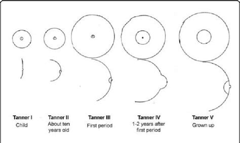 undeveloped tits|Problems with breast development